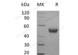 Recombinant Human B4GALT3 Protein (His Tag)