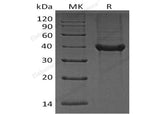 Recombinant Human B4GALT4 Protein (His Tag)