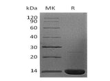 Recombinant Human Beta-2-Microglobulin/B2M Protein (E.coli, His Tag)