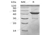 Recombinant Human β-Actin/Beta Actin Protein (His Tag)