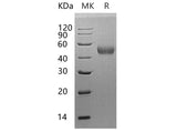 Recombinant Human β-Arrestin 1/ARRB1 Protein (His Tag)