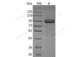 Recombinant Human β-Galactosidase/GLB1 Protein (His Tag)