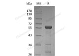 Recombinant Human LACTB2 Protein (GST Tag)