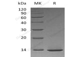 Recombinant Human β-NGF/NGFB Protein (aa 122-241, E. coli)(Active)