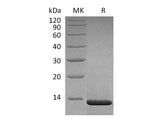 Recombinant Human β-NGF/NGFB Protein (aa 122-23, Human Cells)(Active)