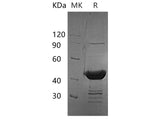 Recombinant Human BUP1 Protein (His Tag)