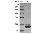 Recombinant Human GGACT Protein (His Tag)