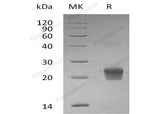 Recombinant Human GGCT Protein (His Tag)