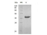 Recombinant Human ECH1 Protein