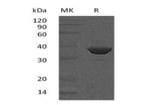 Recombinant Human FBPase 1/FBP1 Protein (Human Cells, His Tag)