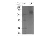 Recombinant Human EGFR/ErbB1 Protein (His Tag)(Active)