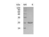 Recombinant Human IFNA4 Protein (His Tag)