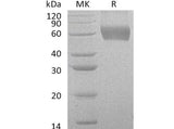 Recombinant Human CSF2RA/GM-CSFR Protein (His Tag)(Active)