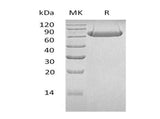 Recombinant Human LAG3/CD223 Protein (His Tag)(Active)