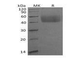 Recombinant Human B7-H6 Protein (His Tag)(Active)