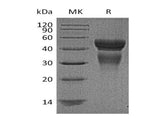 Recombinant Human Interleukin-12/IL-12 Protein (Active)