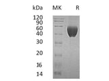 Recombinant Human FSTL1 Protein (His Tag, Human Cells)