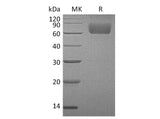 Recombinant Human FGFR3/CD333 Protein (His Tag)