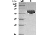 Recombinant Human APOA4 Protein (His Tag)