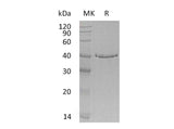 Recombinant Human GMPR Protein (Human Cells, His Tag)