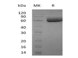 Recombinant Human SMPDL3A Protein (His Tag)