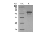 Recombinant Human Reticulocalbin 3/RCN3 Protein (aa 21-328, His Tag)