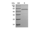 Recombinant Human Calumenin Protein (aa 20-315, His Tag)