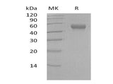 Recombinant Human LRG1 Protein (His Tag)