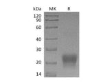 Recombinant Human Tetherin/BST2 Protein (His Tag)