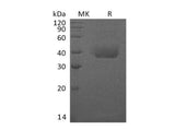 Recombinant Human TEM8/ATR Protein (His Tag)