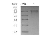 Recombinant Human CLM-9/TREM4 Protein (His Tag)