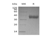 Recombinant Human EPCR Protein (His Tag)