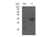 Recombinant Human CALCB Protein (Fc Tag)