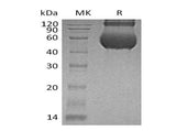 Recombinant Human CDCP1/CD318 Protein (aa 30-341, His Tag)