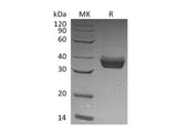 Recombinant Human ERP27 Protein (His Tag)