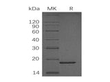 Recombinant Human PPIase/PPIL1 Protein (aa 1-166, His Tag)