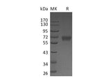 Recombinant Human IZUMO4 Protein (Fc Tag)