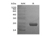 Recombinant Human GM2A Protein (Human Cells, His Tag)