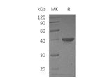 Recombinant Human UBE2I/UBC9 Protein (GST Tag)