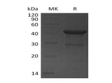 Recombinant Human UBE2D4 Protein (GST Tag)