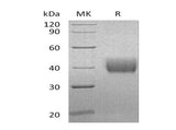 Recombinant Human Mesothelin/MSLN Protein (aa 296-598, His Tag)