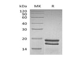 Recombinant Human SUMO1 Protein (His Tag)