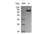 Recombinant Human GOLPH2/GOLM1 Protein (aa 36-401, His Tag)