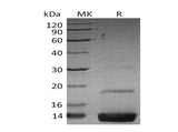 Recombinant Human Resistin Protein (His Tag)