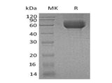 Recombinant Human IL1RL1/ST2 Protein (His Tag)