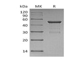 Recombinant Human Ube2H Protein (GST Tag)