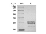 Recombinant Human MAX Protein (His Tag)