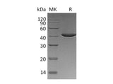 Recombinant Human SERPINB9/PI-9 Protein (Human Cells, His Tag)