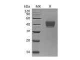 Recombinant Human KIR2DL3 Protein (His Tag)