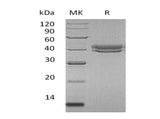 Recombinant Human CFHR1 Protein (His Tag)